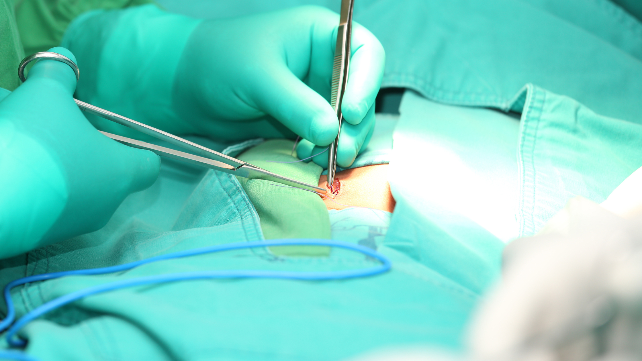 hernia come back after surgery